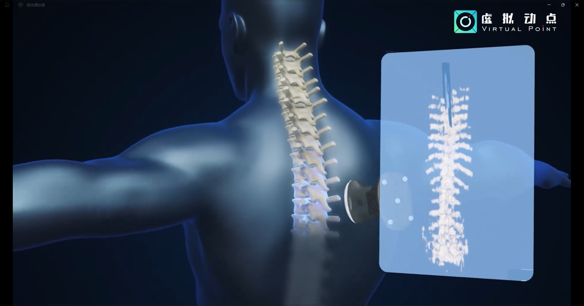 c7c7娱乐平台·虚拟动点OptiTrack开创3D超声成像在脊柱诊断中的应用